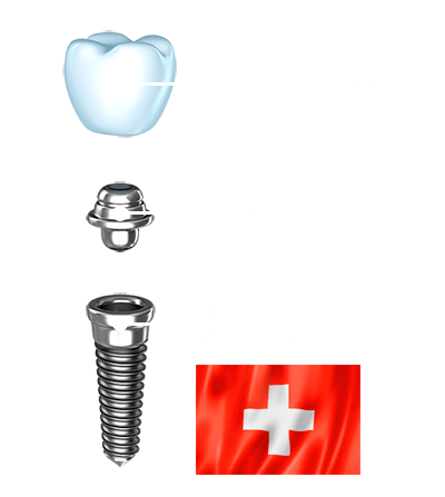 Стоматология акция импланты дантистофф