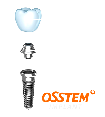 Стоматология акция импланты дантистофф