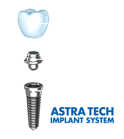 Стоматология акция импланты дантистофф