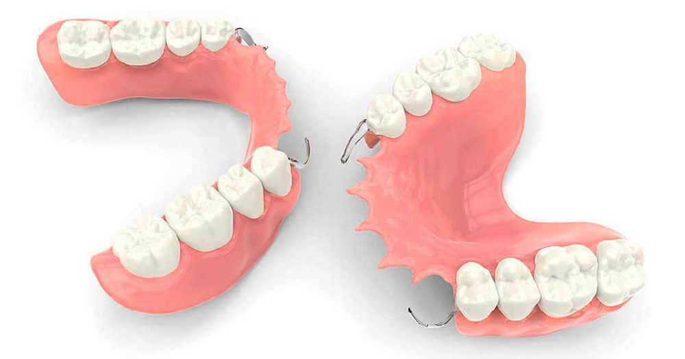 Съемные зубные протезы: фото, особенности, уход