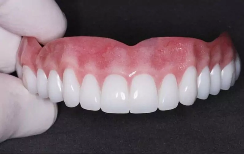 Какие зубные протезы самые лучшие и удобные – виды и что выбрать