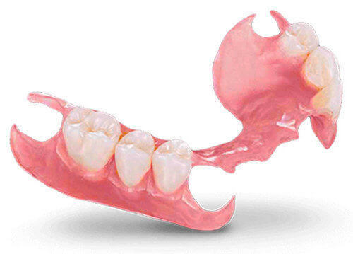 Частичный съемный зубной протез