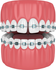 Ортодонтия