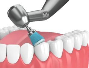 Профессиональная гигиена полости рта