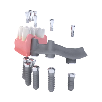 Straumann Pro Arch